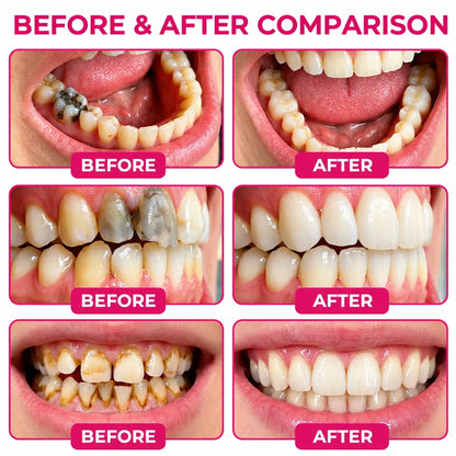 Last Day Today only Low Price